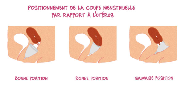 coupe-menstruelle-col-uterus
